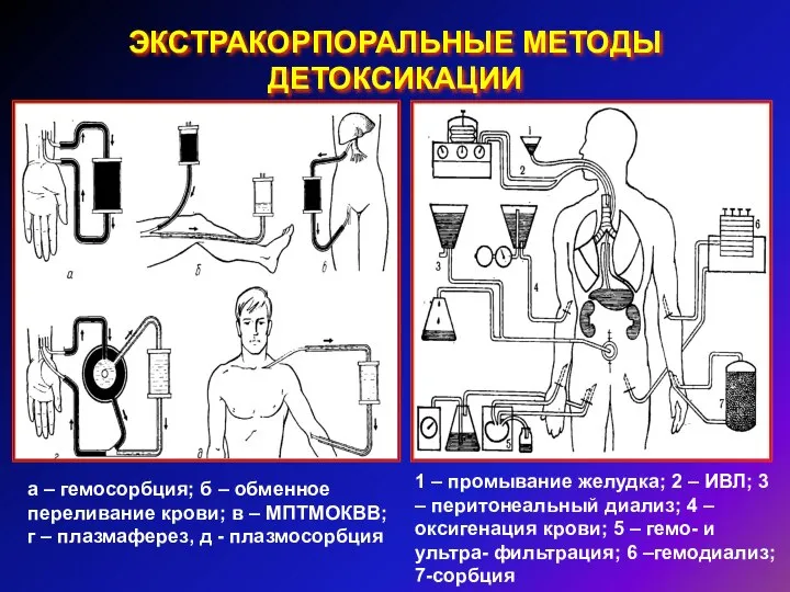 ЭКСТРАКОРПОРАЛЬНЫЕ МЕТОДЫ ДЕТОКСИКАЦИИ а – гемосорбция; б – обменное переливание крови;