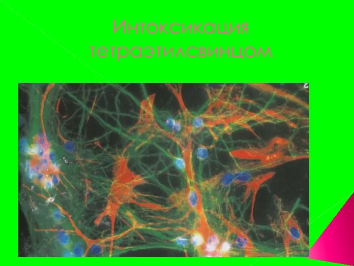 Интоксикация тетраэтилсвинцом