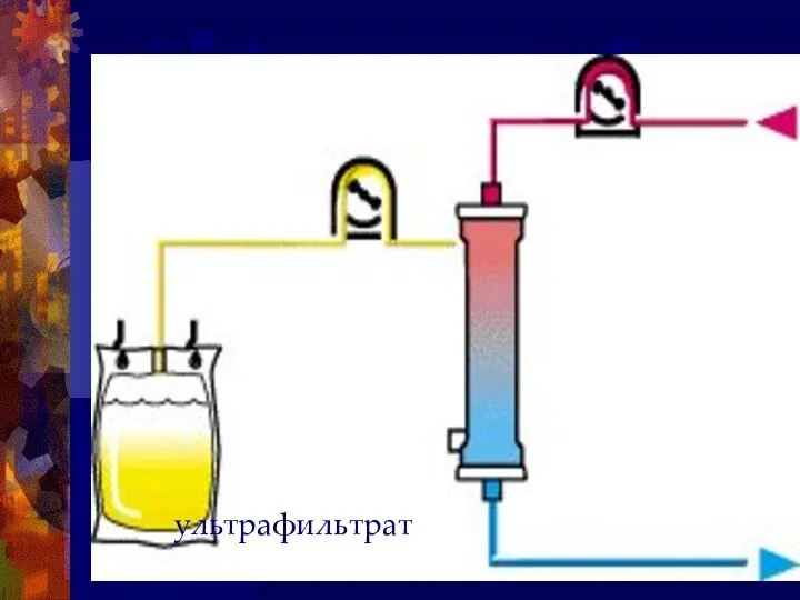 ультрафильтрат