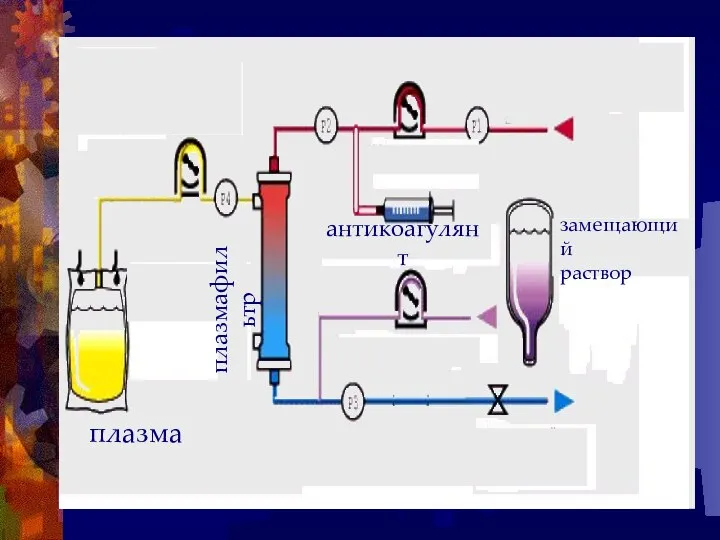 плазмафильтр плазма антикоагулянт замещающий раствор