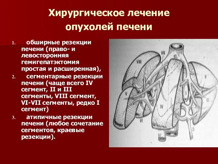 Хирургическое лечение опухолей печени обширные резекции печени (право- и левосторонняя гемигепатэктомия