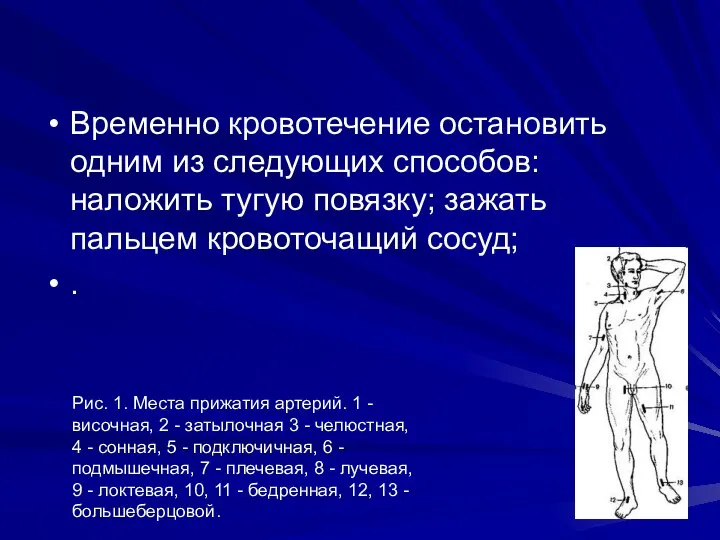 Временно кровотечение остановить одним из следующих способов: наложить тугую повязку; зажать