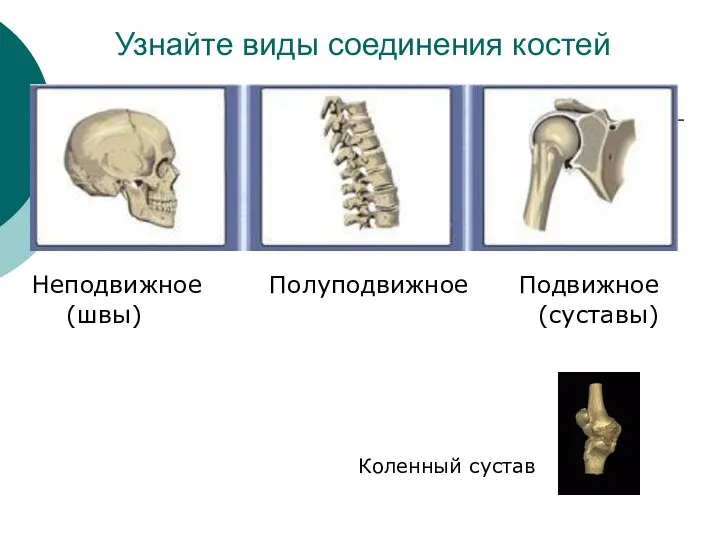 Узнайте виды соединения костей Неподвижное Полуподвижное Подвижное (швы) (суставы) Коленный сустав