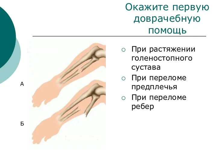 При растяжении голеностопного сустава При переломе предплечья При переломе ребер А Б Окажите первую доврачебную помощь