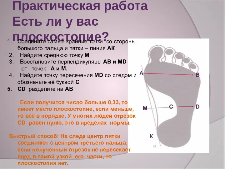 Практическая работа Есть ли у вас плоскостопие? А В М D