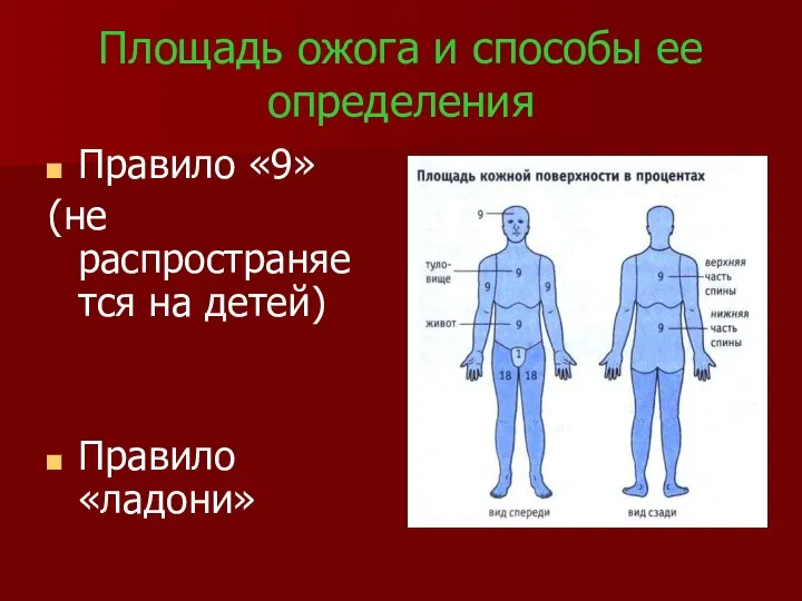 Площадь ожога и способы ее определения Правило «9» (не распространяется на детей) Правило «ладони»