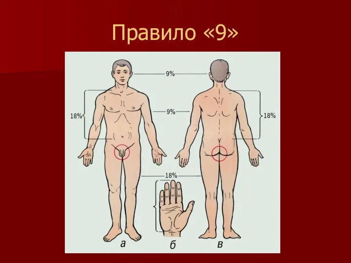 Правило «9»