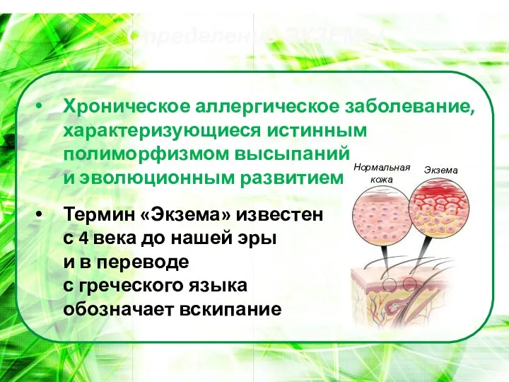 Определение ЭКЗЕМЫ Хроническое аллергическое заболевание, характеризующиеся истинным полиморфизмом высыпаний и эволюционным