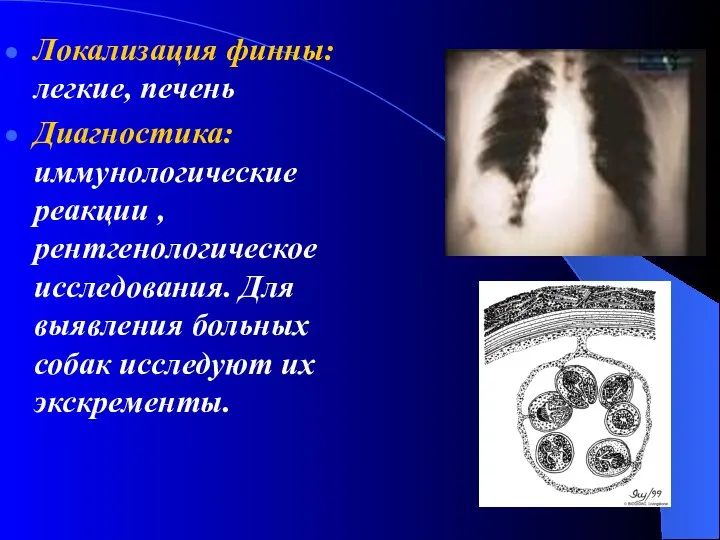 Локализация финны: легкие, печень Диагностика: иммунологические реакции , рентгенологическое исследования. Для