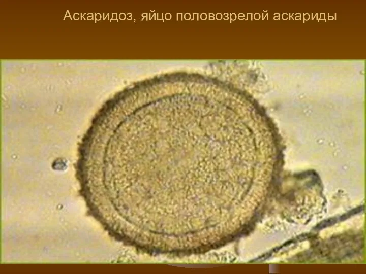 Аскаридоз, яйцо половозрелой аскариды