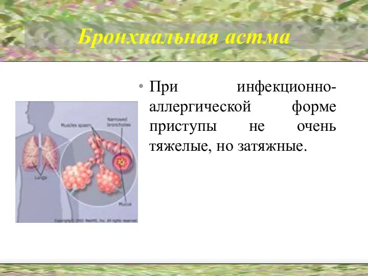 Бронхиальная астма При инфекционно-аллергической форме приступы не очень тяжелые, но затяжные.