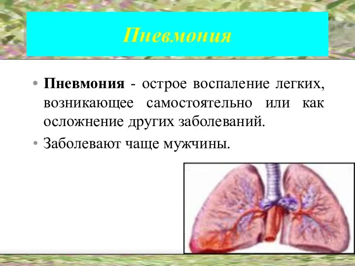 Пневмония Пневмония - острое воспаление легких, возникающее самостоятельно или как осложнение других заболеваний. Заболевают чаще мужчины.