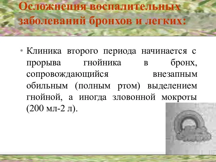 Осложнения воспалительных заболеваний бронхов и легких: Клиника второго периода начинается с