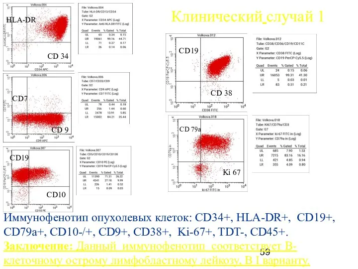 HLA-DR CD 34 CD7 CD 9 Клинический случай 1 Иммунофенотип опухолевых