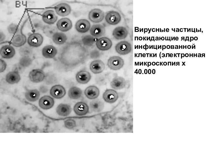 Вирусные частицы, покидающие ядро инфицированной клетки (электронная микроскопия х 40.000