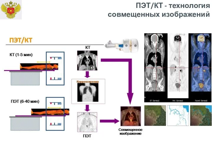 ПЭТ/КТ - технология совмещенных изображений