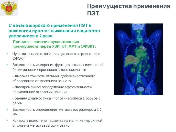 Причина – наличие существенных преимуществ перед УЗИ, КТ, МРТ и ОФЭКТ: