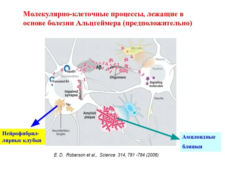 Молекулярно-клеточные процессы, лежащие в основе болезни Альцгеймера (предположительно) Амилоидные бляшки Нейрофибрил-лярные клубки