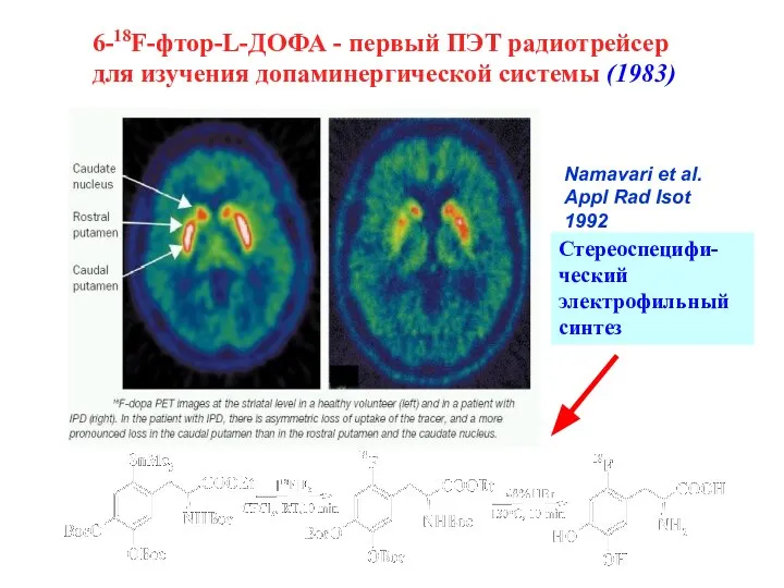 6-18F-фтор-L-ДОФА - первый ПЭТ радиотрейсер для изучения допаминергической системы (1983) Стереоспецифи-
