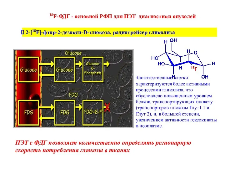 18F-ФДГ - основной РФП для ПЭТ диагностики опухолей 2-[18F]-фтор-2-дезокси-D-глюкоза, радиотрейсер гликолиза