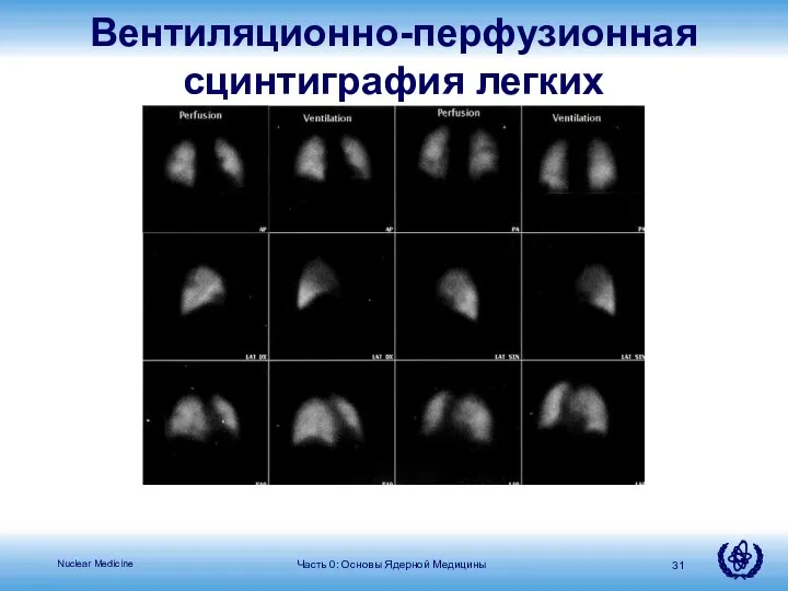 Часть 0: Основы Ядерной Медицины Вентиляционно-перфузионная сцинтиграфия легких