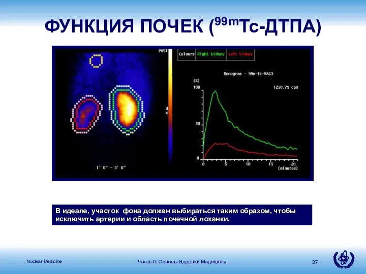 Часть 0: Основы Ядерной Медицины В идеале, участок фона должен выбираться