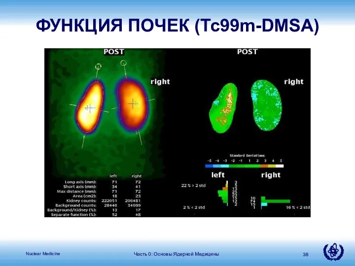 Часть 0: Основы Ядерной Медицины ФУНКЦИЯ ПОЧЕК (Tc99m-DMSA)