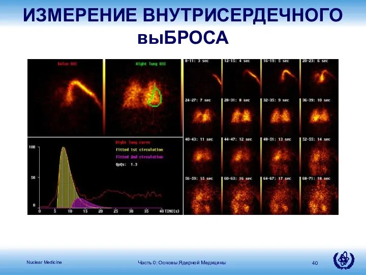 Часть 0: Основы Ядерной Медицины ИЗМЕРЕНИЕ ВНУТРИСЕРДЕЧНОГО выБРОСА