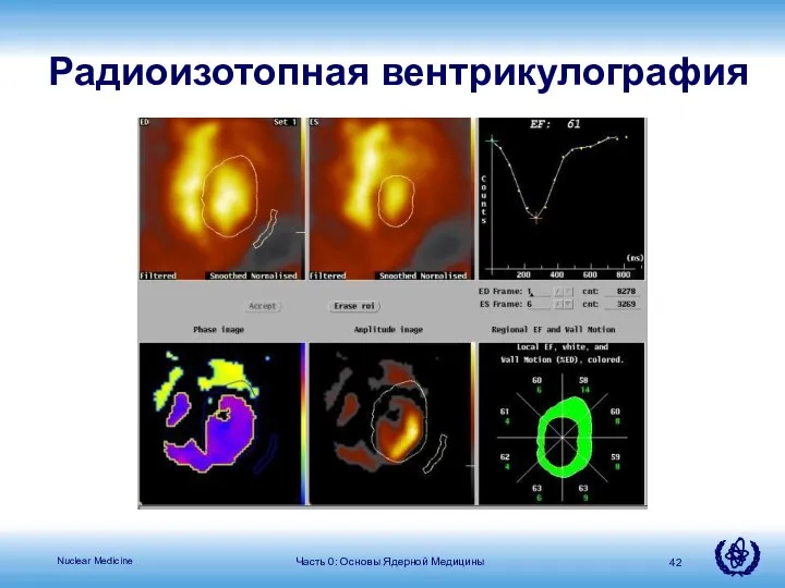 Часть 0: Основы Ядерной Медицины Радиоизотопная вентрикулография