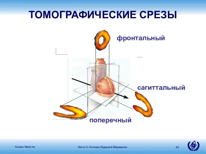 Часть 0: Основы Ядерной Медицины фронтальный поперечный сагиттальный ТОМОГРАФИЧЕСКИЕ СРЕЗЫ