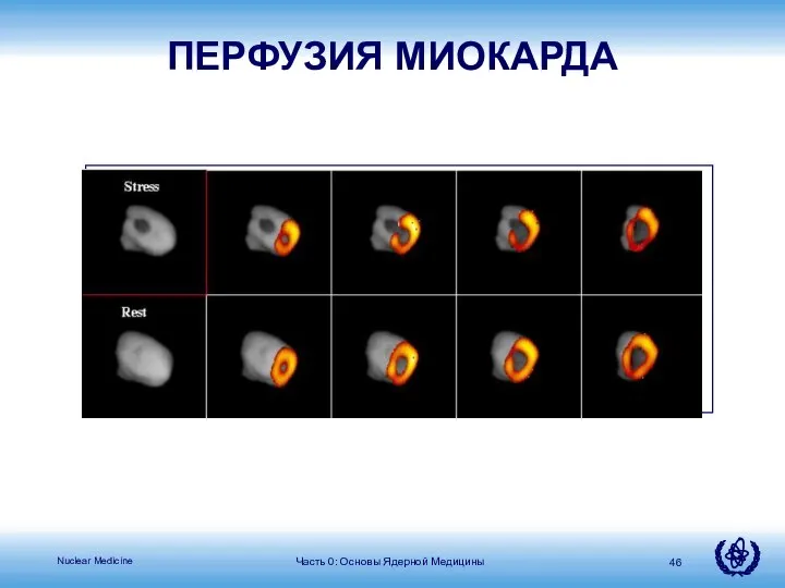 Часть 0: Основы Ядерной Медицины ПЕРФУЗИЯ МИОКАРДА