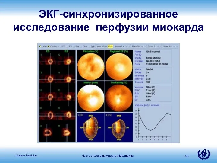 Часть 0: Основы Ядерной Медицины ЭКГ-синхронизированное исследование перфузии миокарда