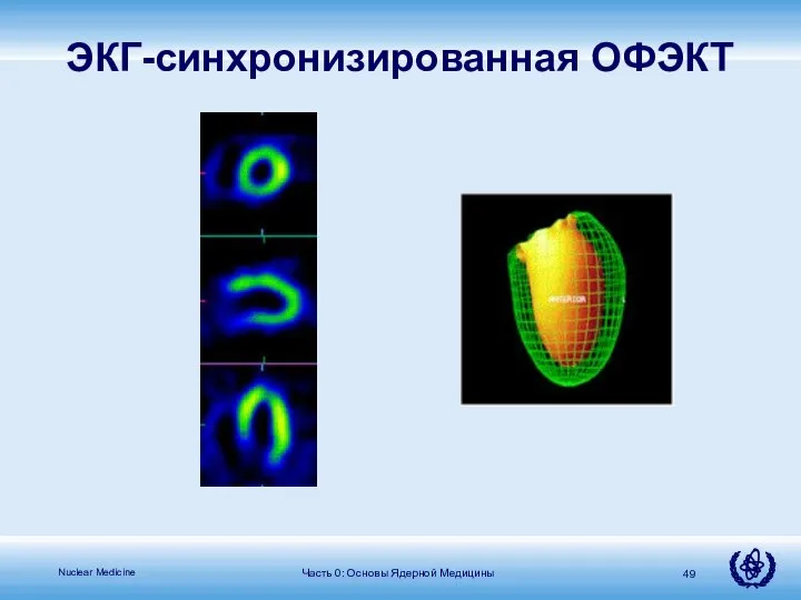 Часть 0: Основы Ядерной Медицины ЭКГ-синхронизированная ОФЭКТ