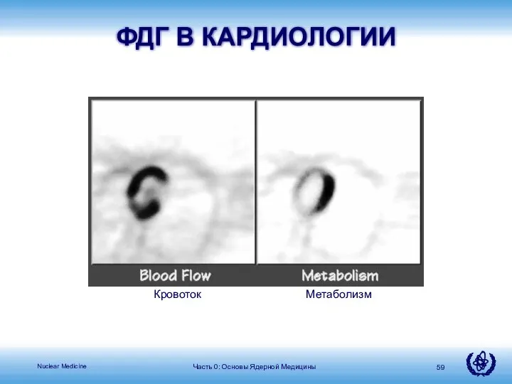 Часть 0: Основы Ядерной Медицины ФДГ В КАРДИОЛОГИИ Кровоток Метаболизм