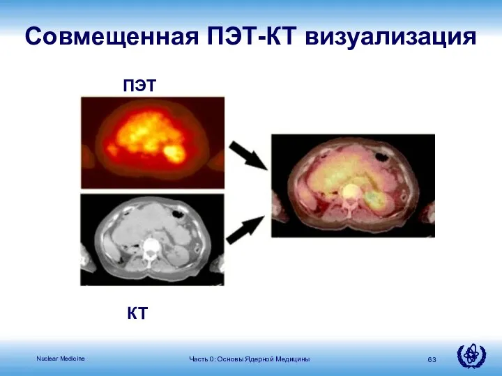 Часть 0: Основы Ядерной Медицины Совмещенная ПЭТ-КТ визуализация ПЭТ КТ