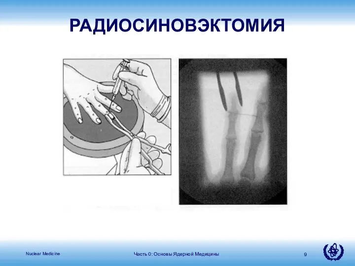 РАДИОСИНОВЭКТОМИЯ Часть 0: Основы Ядерной Медицины