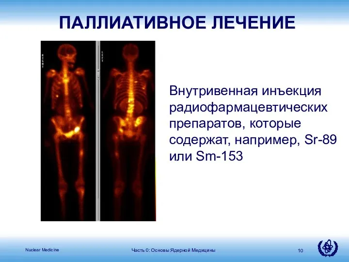 ПАЛЛИАТИВНОЕ ЛЕЧЕНИЕ Внутривенная инъекция радиофармацевтических препаратов, которые содержат, например, Sr-89 или