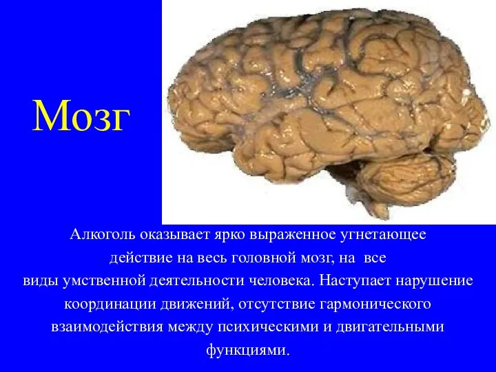 Мозг Алкоголь оказывает ярко выраженное угнетающее действие на весь головной мозг,