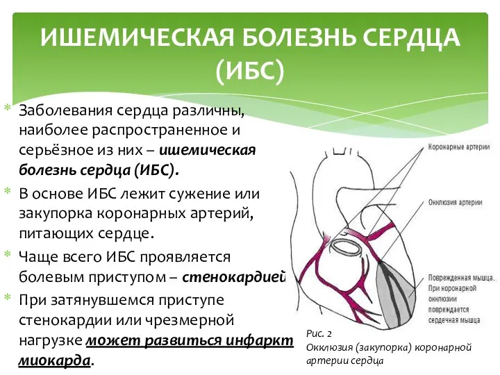 Заболевания сердца различны, наиболее распространенное и серьёзное из них – ишемическая