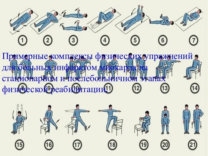 Примерные комплексы физических упражнений для больных инфарктом миокарда на стационарном и послебольничном этапах физической реабилитации.