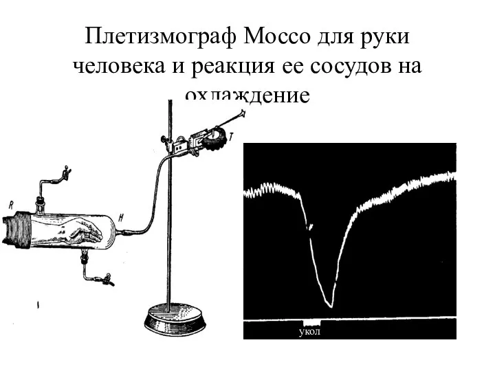 Плетизмограф Моссо для руки человека и реакция ее сосудов на охлаждение укол