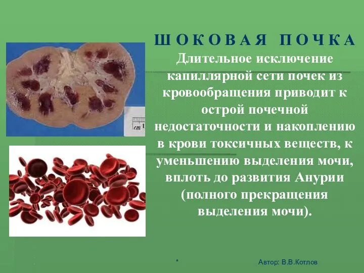 ШОК - ЭТО АКТИВНАЯ ЗАЩИТА ОРГАНИЗМА ОТ АГРЕССИИ СРЕДЫ Ш О