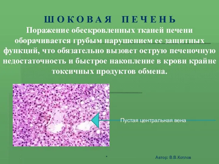 ШОК - ЭТО АКТИВНАЯ ЗАЩИТА ОРГАНИЗМА ОТ АГРЕССИИ СРЕДЫ Ш О