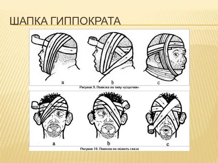 Шапка Гиппократа