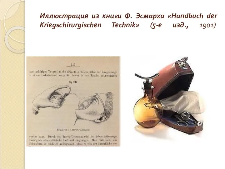 Иллюстрация из книги Ф. Эсмарха «Handbuch der Kriegschirurgischen Technik» (5-е изд., 1901)