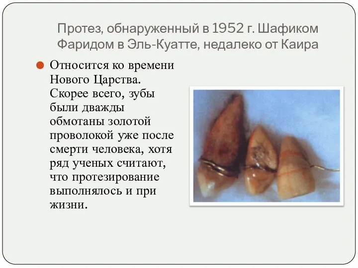Протез, обнаруженный в 1952 г. Шафиком Фаридом в Эль-Куатте, недалеко от