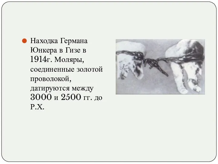 Находка Германа Юнкера в Гизе в 1914г. Моляры, соединенные золотой проволокой,