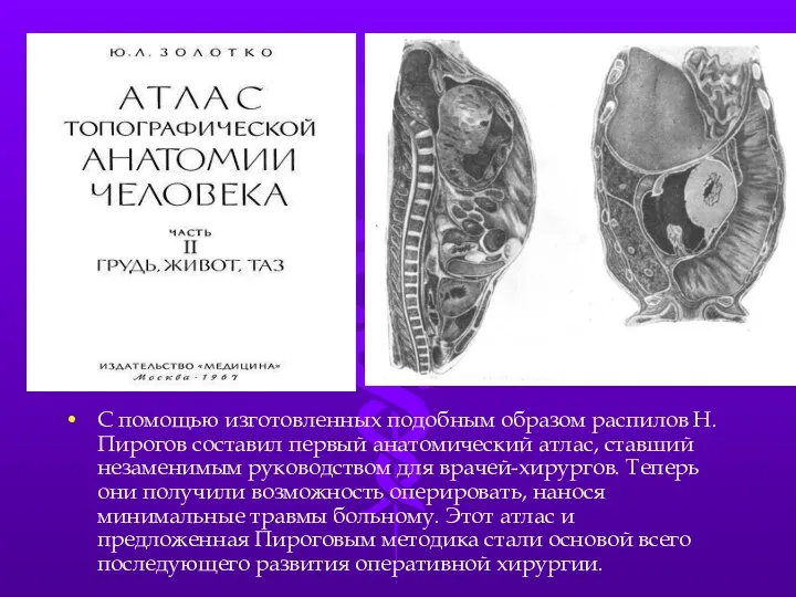 С помощью изготовленных подобным образом распилов Н. Пирогов составил первый анатомический