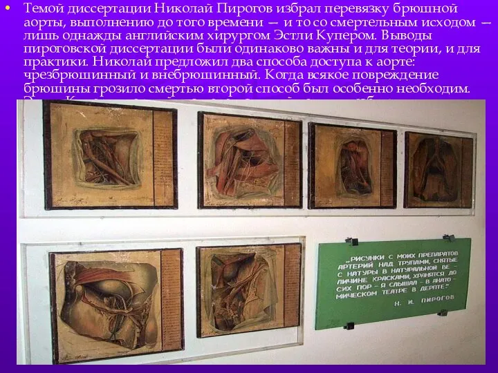 Темой диссертации Николай Пирогов избрал перевязку брюшной аорты, выполнению до того