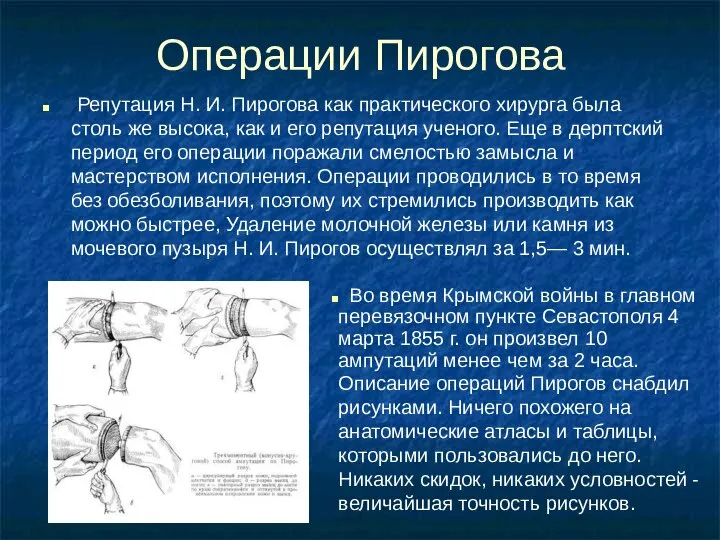 Операции Пирогова Репутация Н. И. Пирогова как практического хирурга была столь